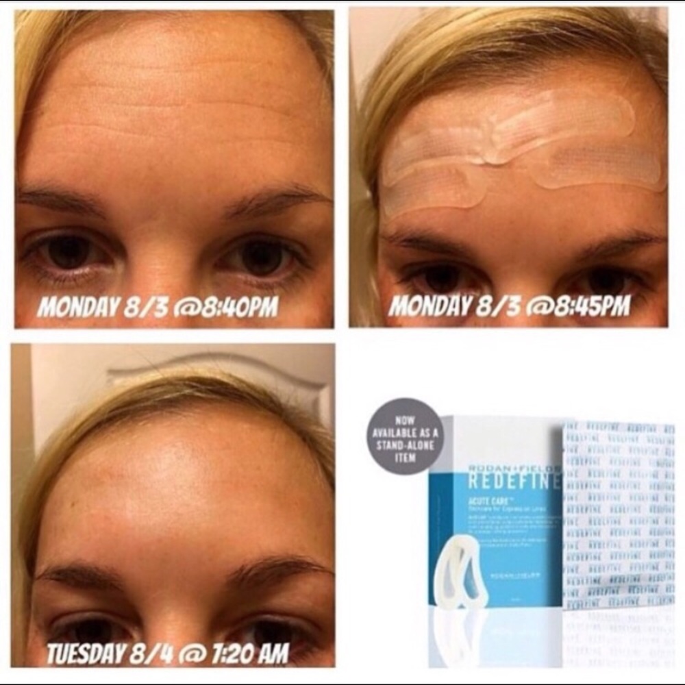 R+F Acute Care Redefine Wrinkle Strips - Picture 3 of 7